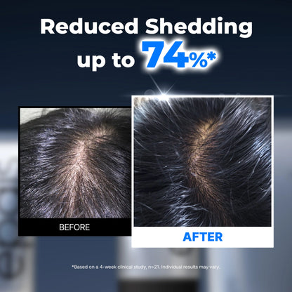 Cooling Scalp Serum with Brush Applicator