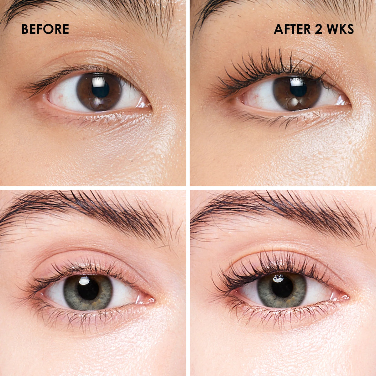 before-after
