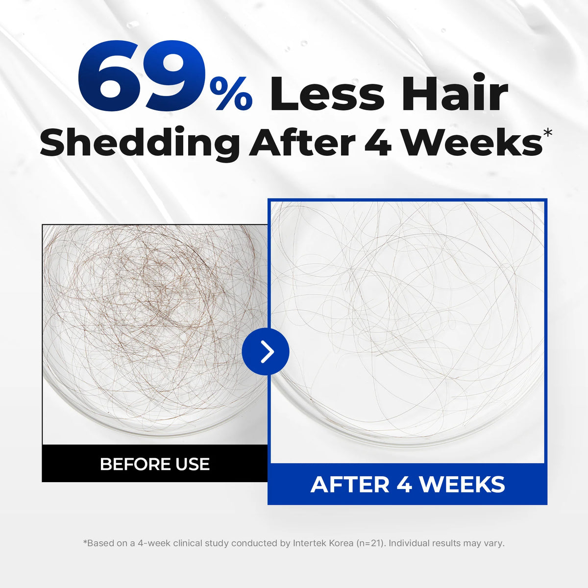 Intensive scalp treatment with cooling steel roll-on